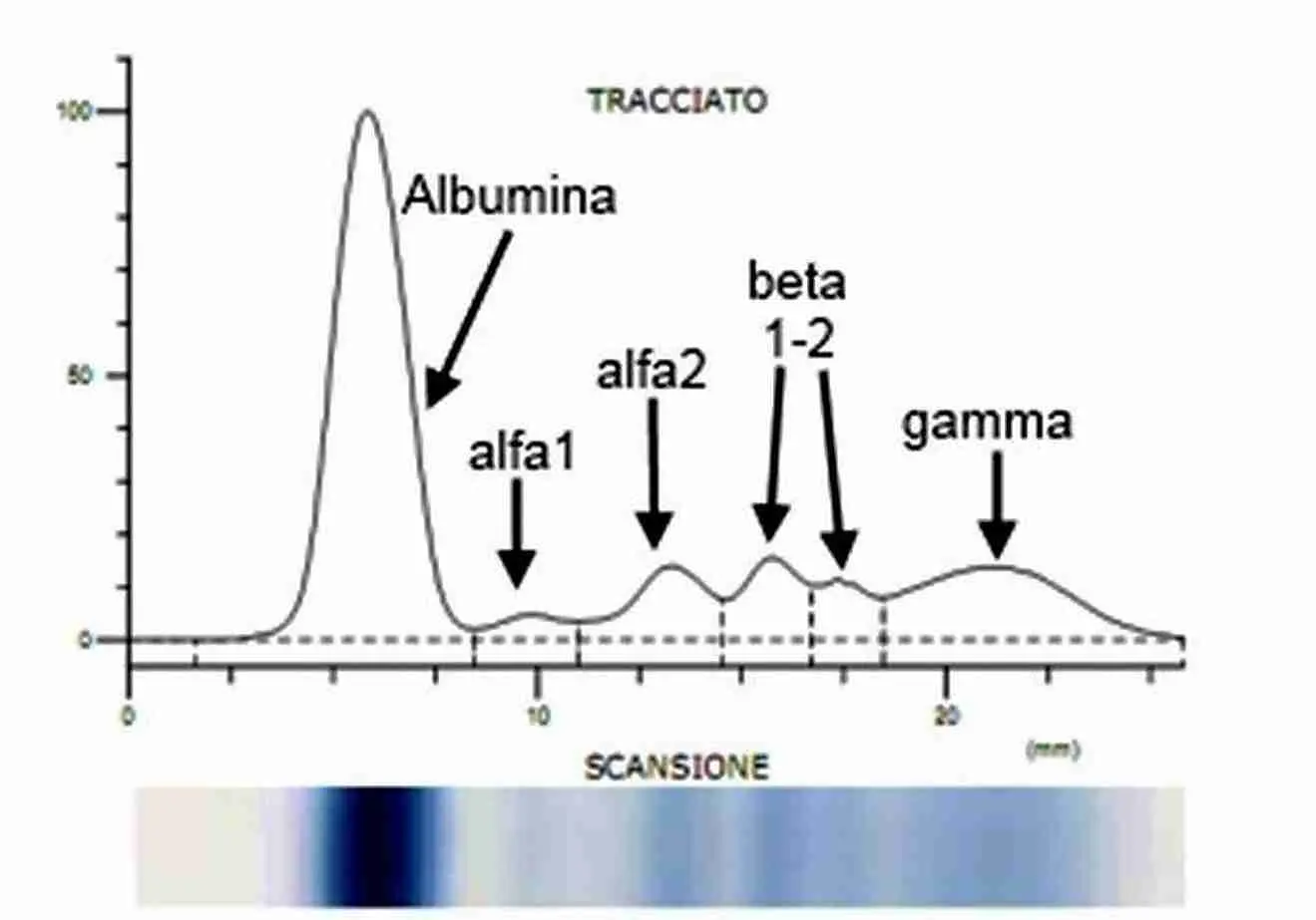 Struttura Del Diagramma Proteico Proteine Bioitas